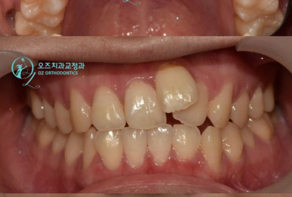 로그인 후 더 많은 전 후 사진을 확인하세요.